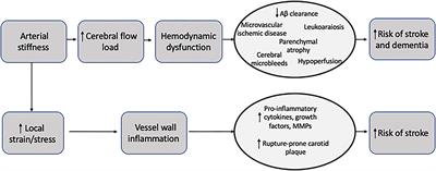 Carotid Artery Stiffness: Imaging Techniques and Impact on Cerebrovascular Disease